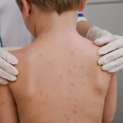 João Pessoa confirma caso de meningite em criança de 7 anos e monitora outros dois